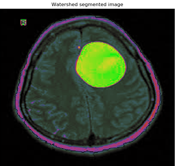 segmentation