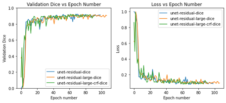 Model optimization using dice loss