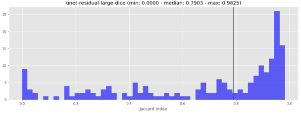 Model results: unet residual large dice