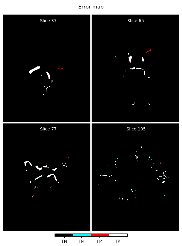 error map of segmentation with half unet