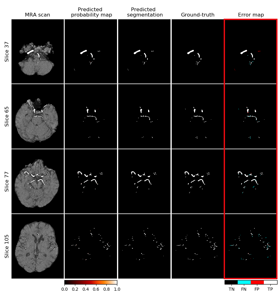 segmentation with full unet