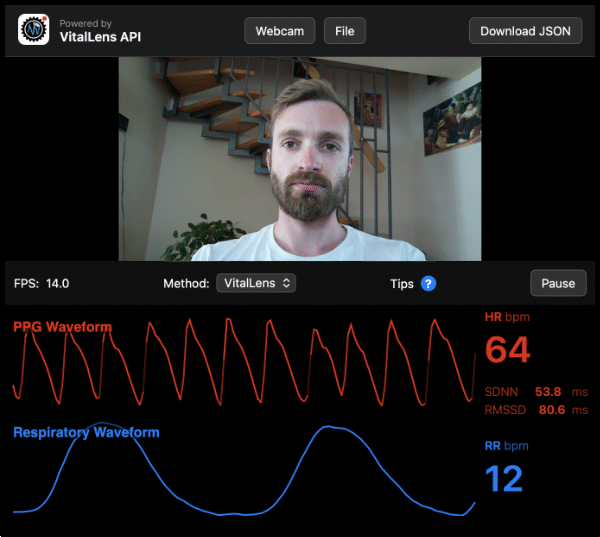 vitallens.js widget screenshot
