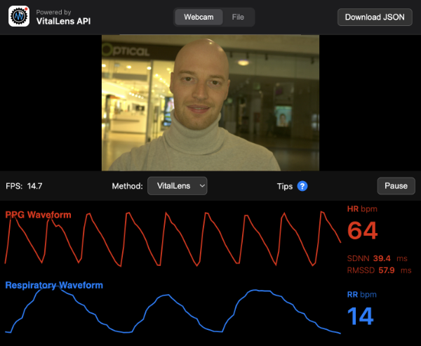 vitallens.js widget screenshot