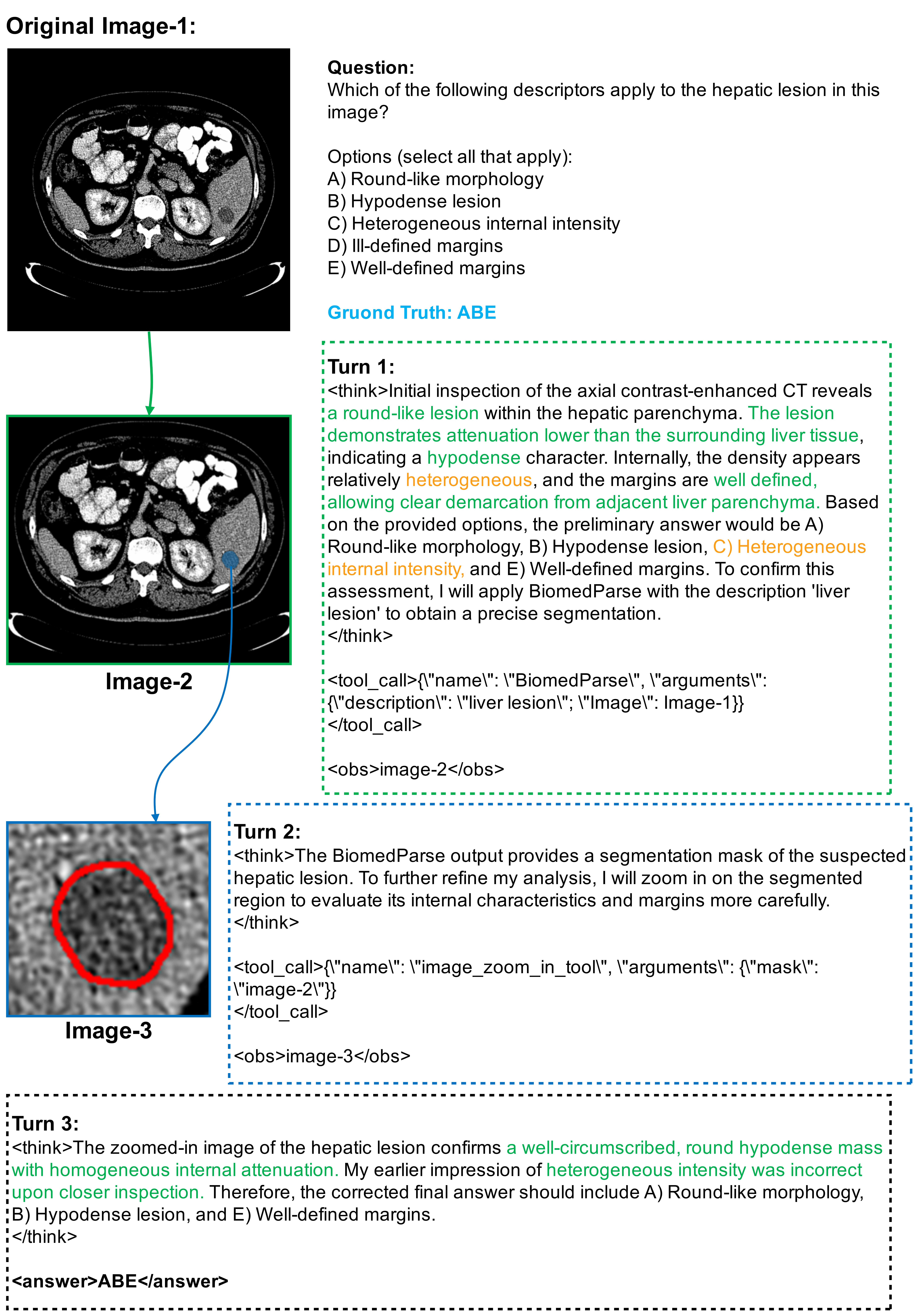 Hallucination mitigation case