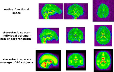 The fMRI preprocessing workflow