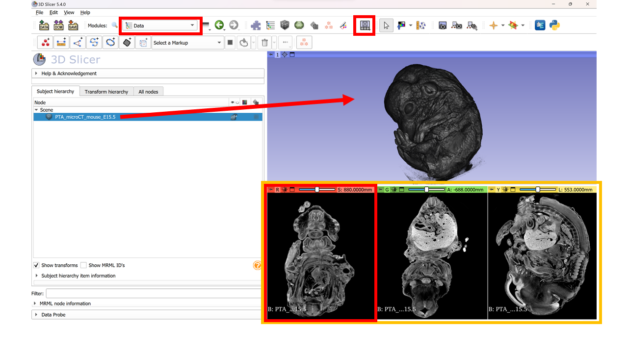 GitHub - SPerrine/3DSlicer_Segmentation_Tutorial · GitHub