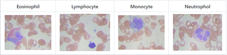 WBC classification using traditional image processing.