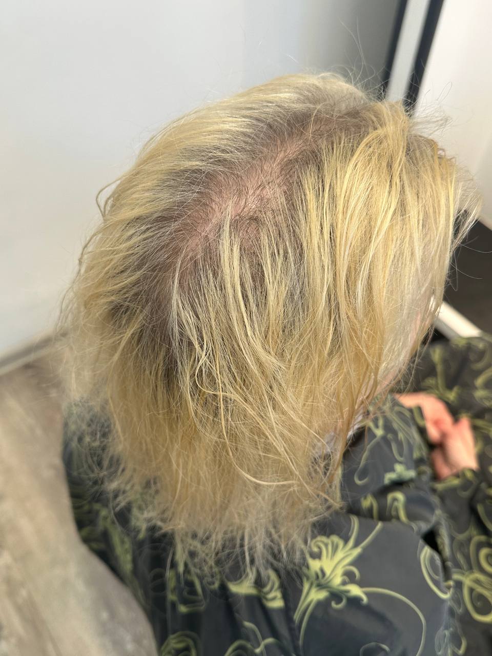 Before