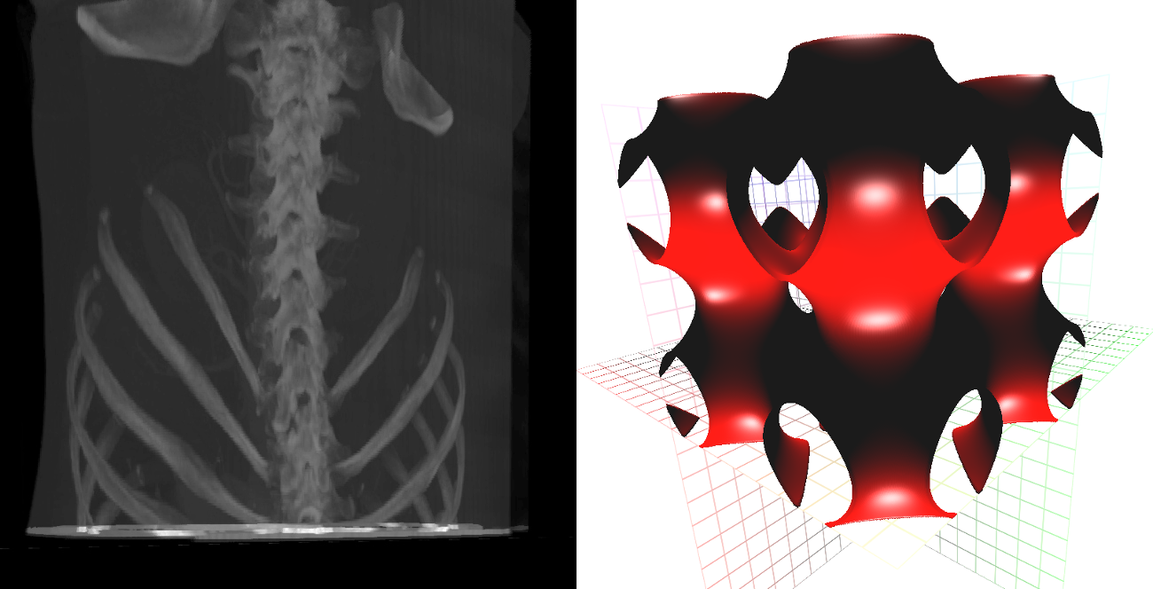 maximum intensity projection + iso image