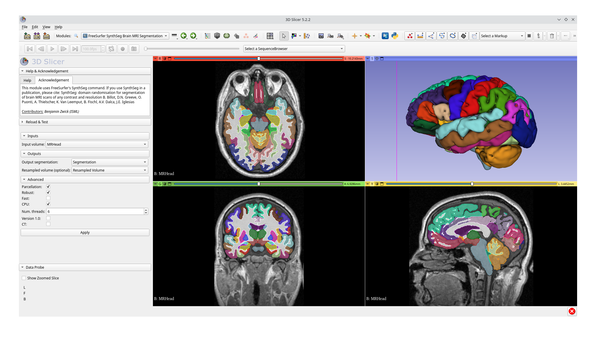 FreeSurfer SynthSeg Brain MRI Segmentation