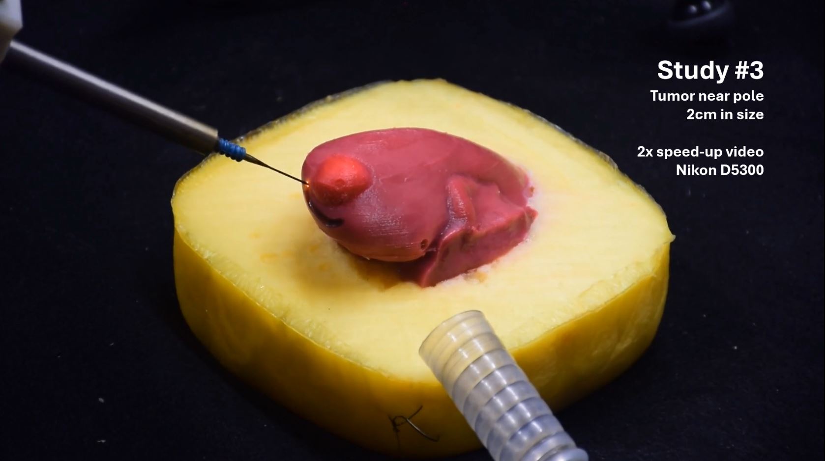 2025_JMRR_CAO_Resection