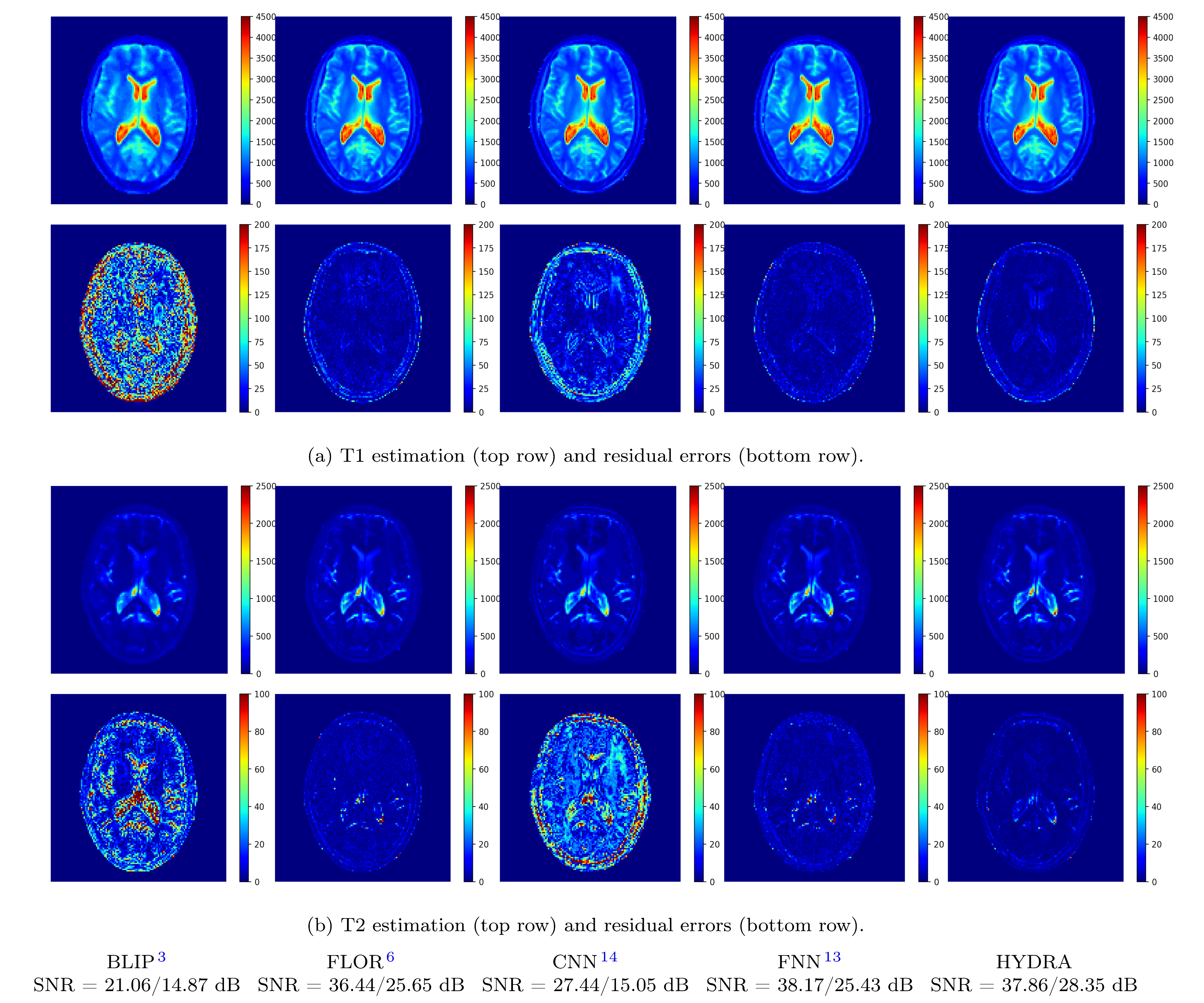 Figure: Testing on the anatomical dataset with k-space Gaussian subsampling.