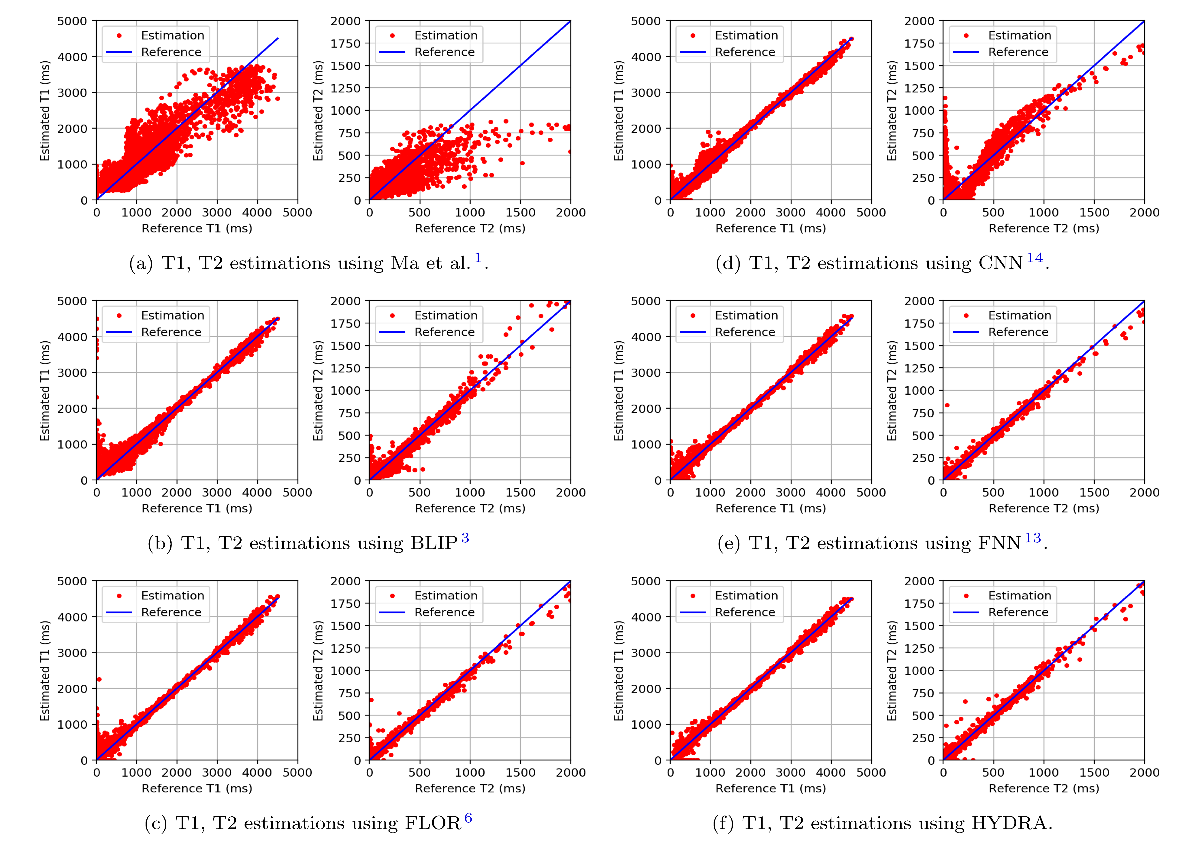 Figure: Testing on the anatomical dataset with k-space spiral subsampling.