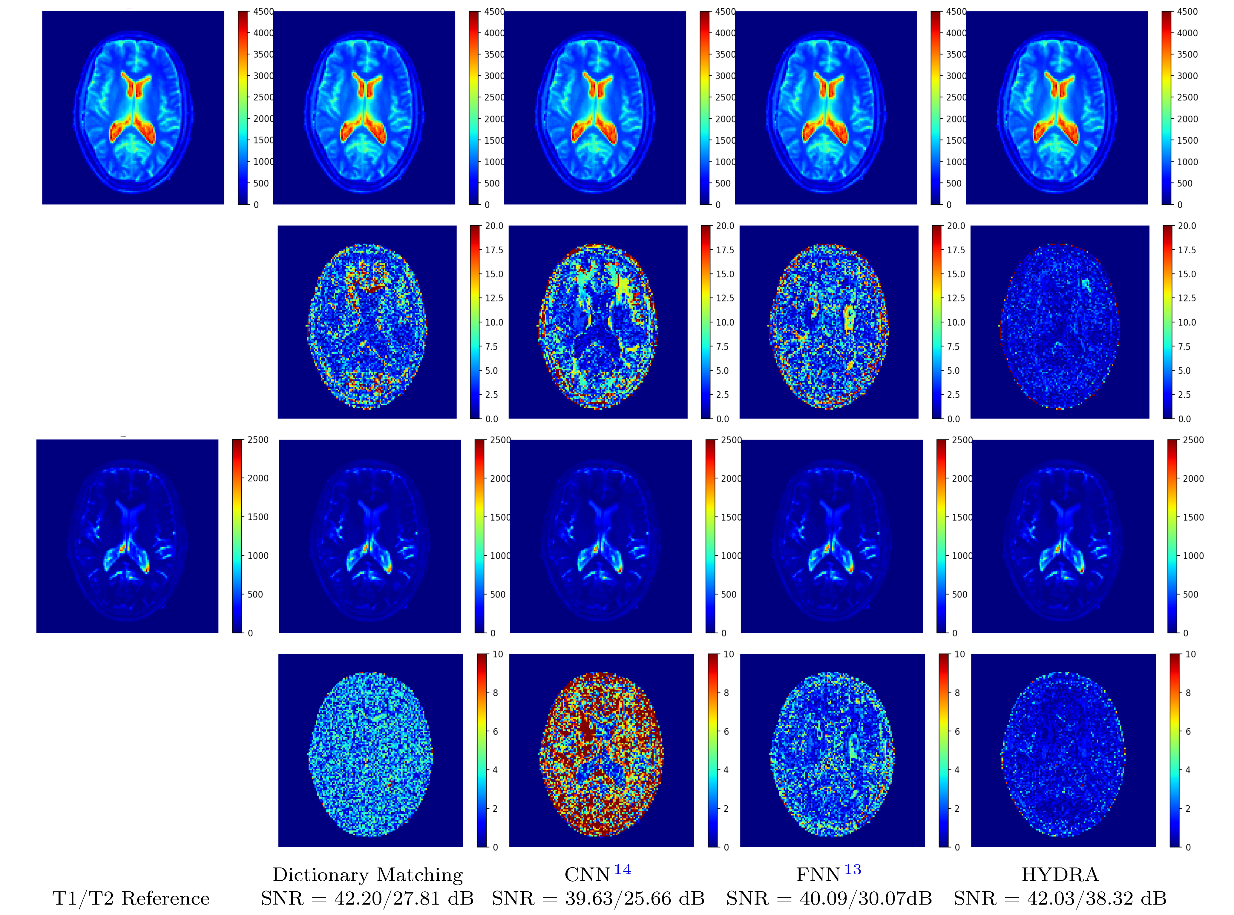 Figure: Visual results of testing on anatomical dataset with full k-space sampling.