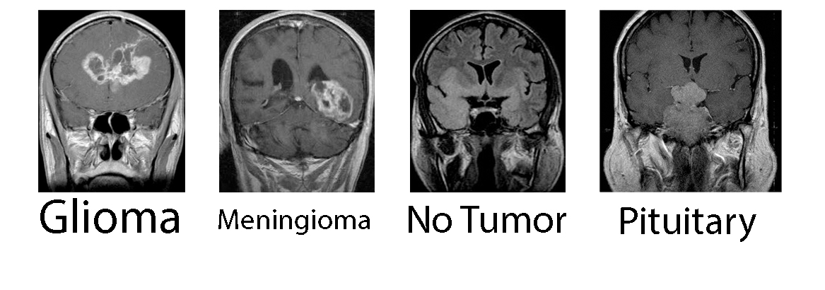 Tumor classes