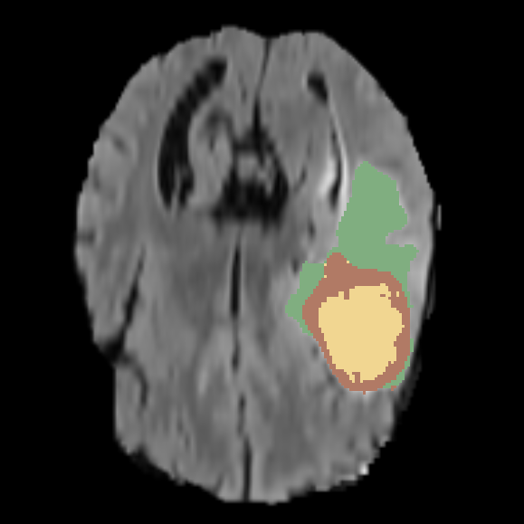 2D Labeled Brain Image