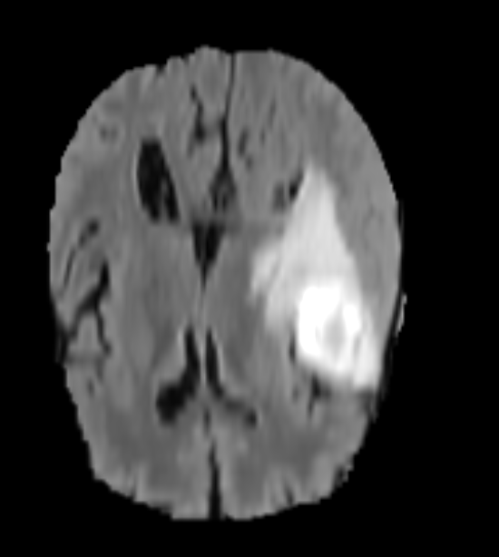 2D Unlabled Brain Image