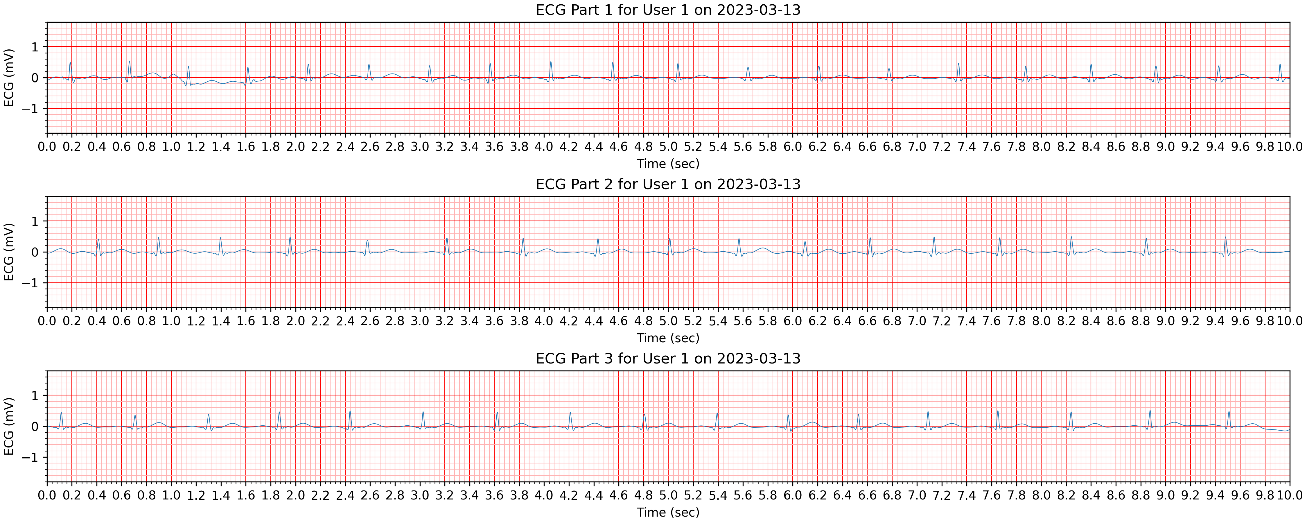 ecg_data_plot.png