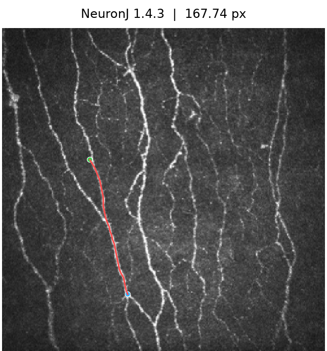 Official NeuronJ result