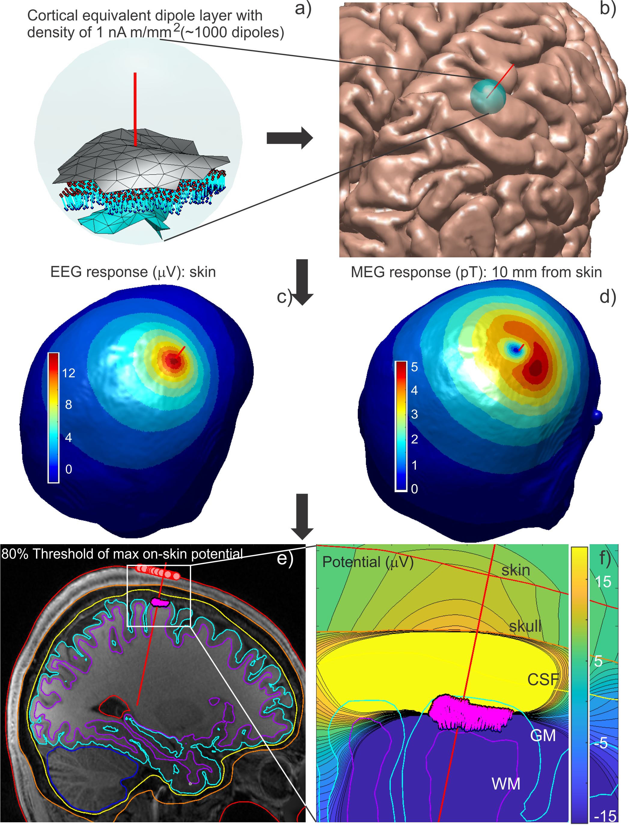 a) Elementary cortical dipoles placed between the gray matter surface and white matter surface within the region indicated in (b). b) Blue sphere on the gray matter surface indicates the position of the cluster of dipoles in (a). c) EEG response (Volts) arising from the dipole configuration in (a) viewed on the skin surface. d) MEG response (pico-teslas) arising from the dipole configuration in (a) viewed on the skin surface. e) Coregistration of head model against original MRI data in the sagittal plane.  Small pink circles are drawn at locations on the scalp that experience strong EEG/MEG fields. f) Contour plot of potential (micro-volts) in the region subtended by the white box in (e).