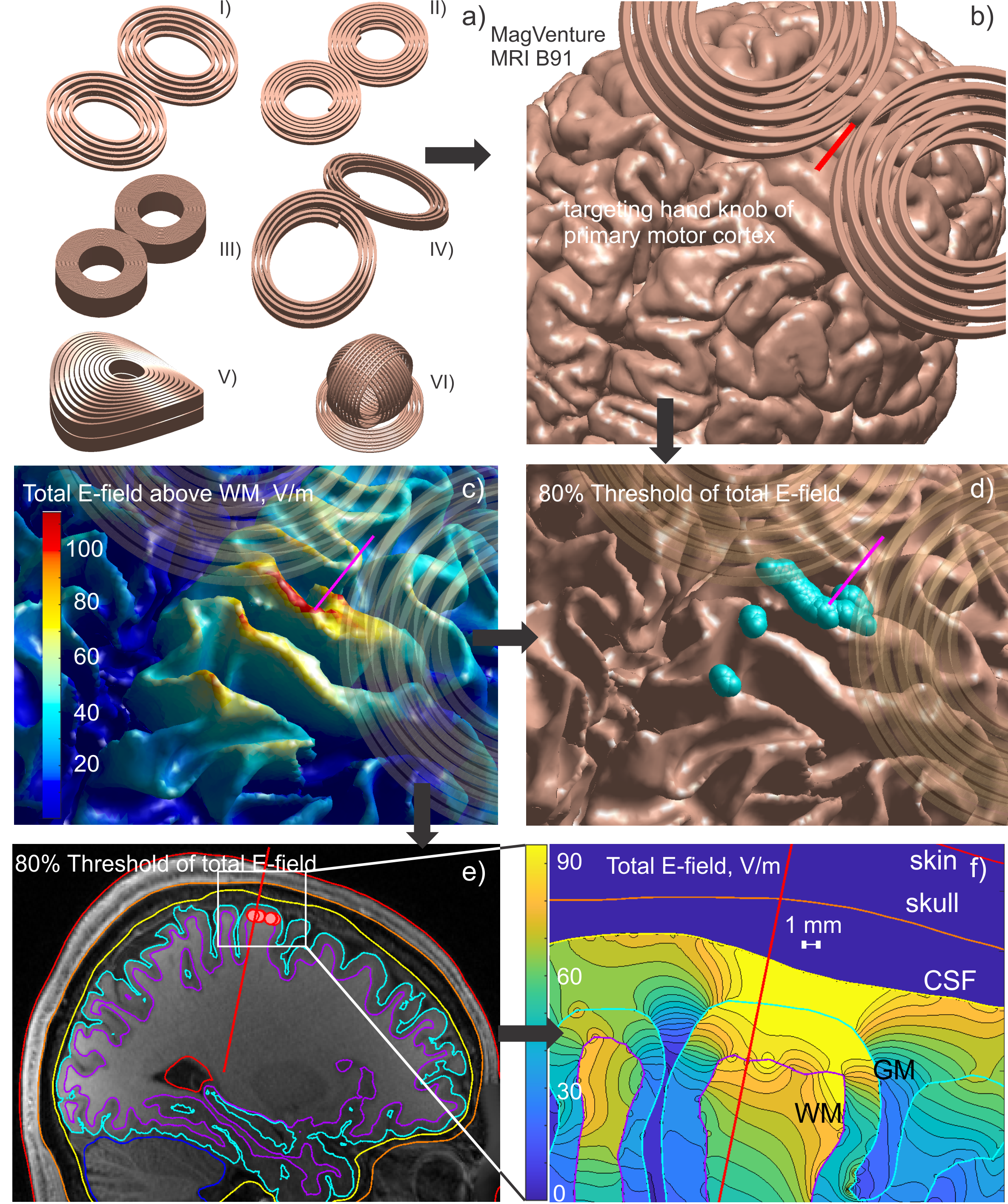 a) A selection of TMS coils available for use in the toolkit. b) MagVenture MRI-B91 coil positioned above the motor hand area of the gray matter surface of Connectome Subject 110411. c) Electric field magnitude at the white matter surface. d) Thresholded electric field magnitude at the white matter surface. e) Coregistration of head model contours against original NIfTI data. f) Contour plot of E-field magnitude within the area subtended by the white box in (e).