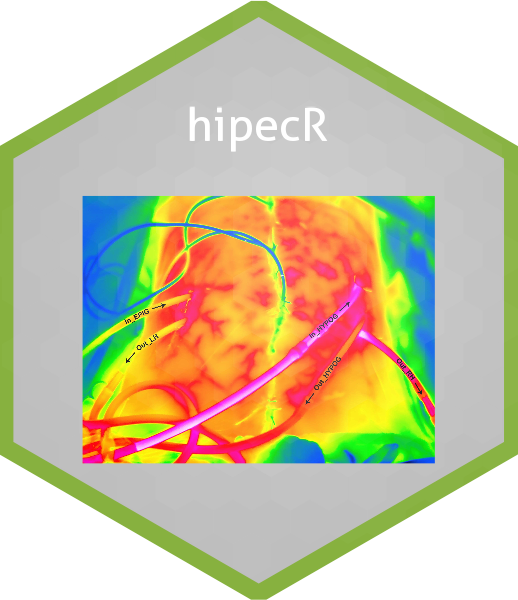 hipecR_hex