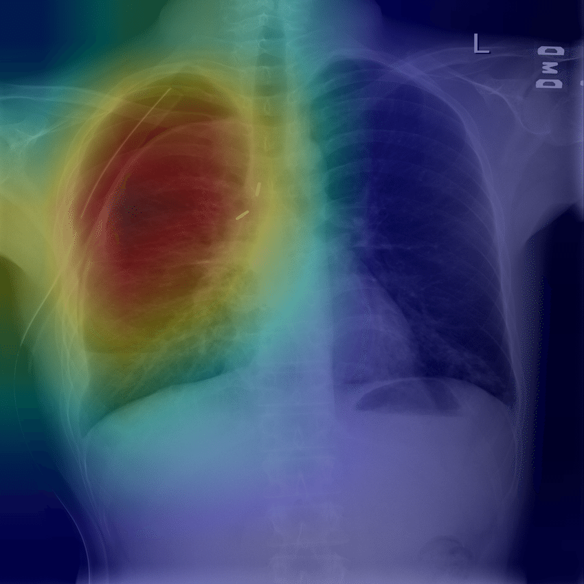 Chest Radiograph