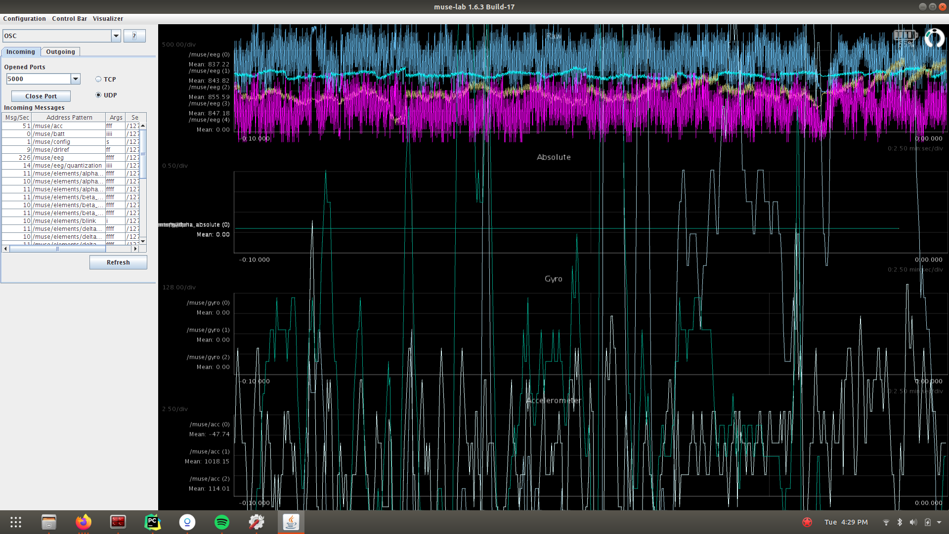 Brainwaves