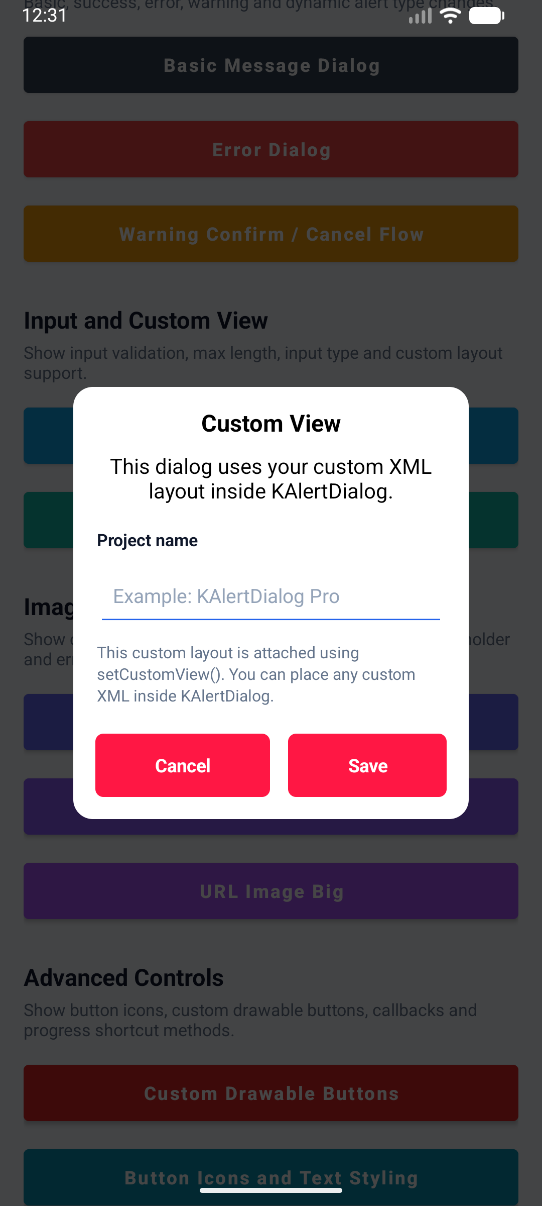 KAlert Dialog Custom View Dialog