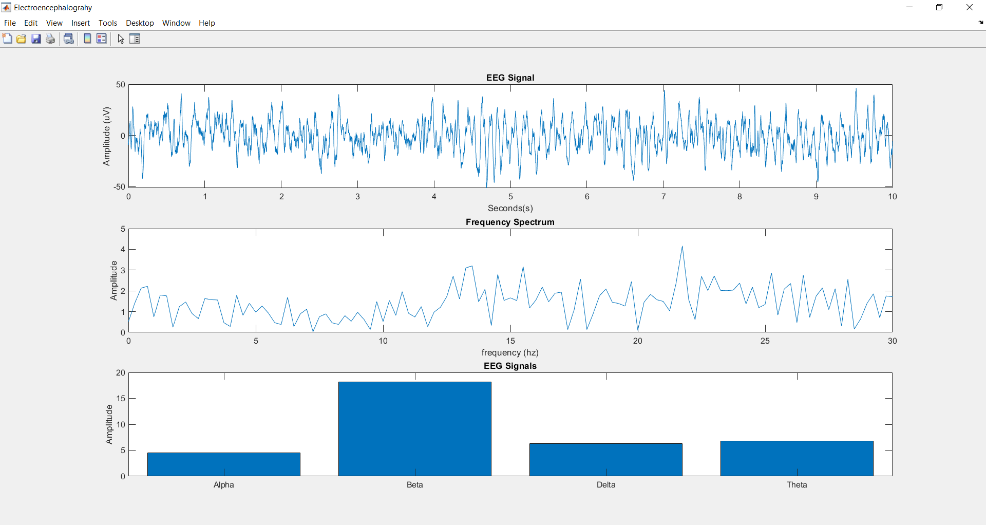  EEG Chart 