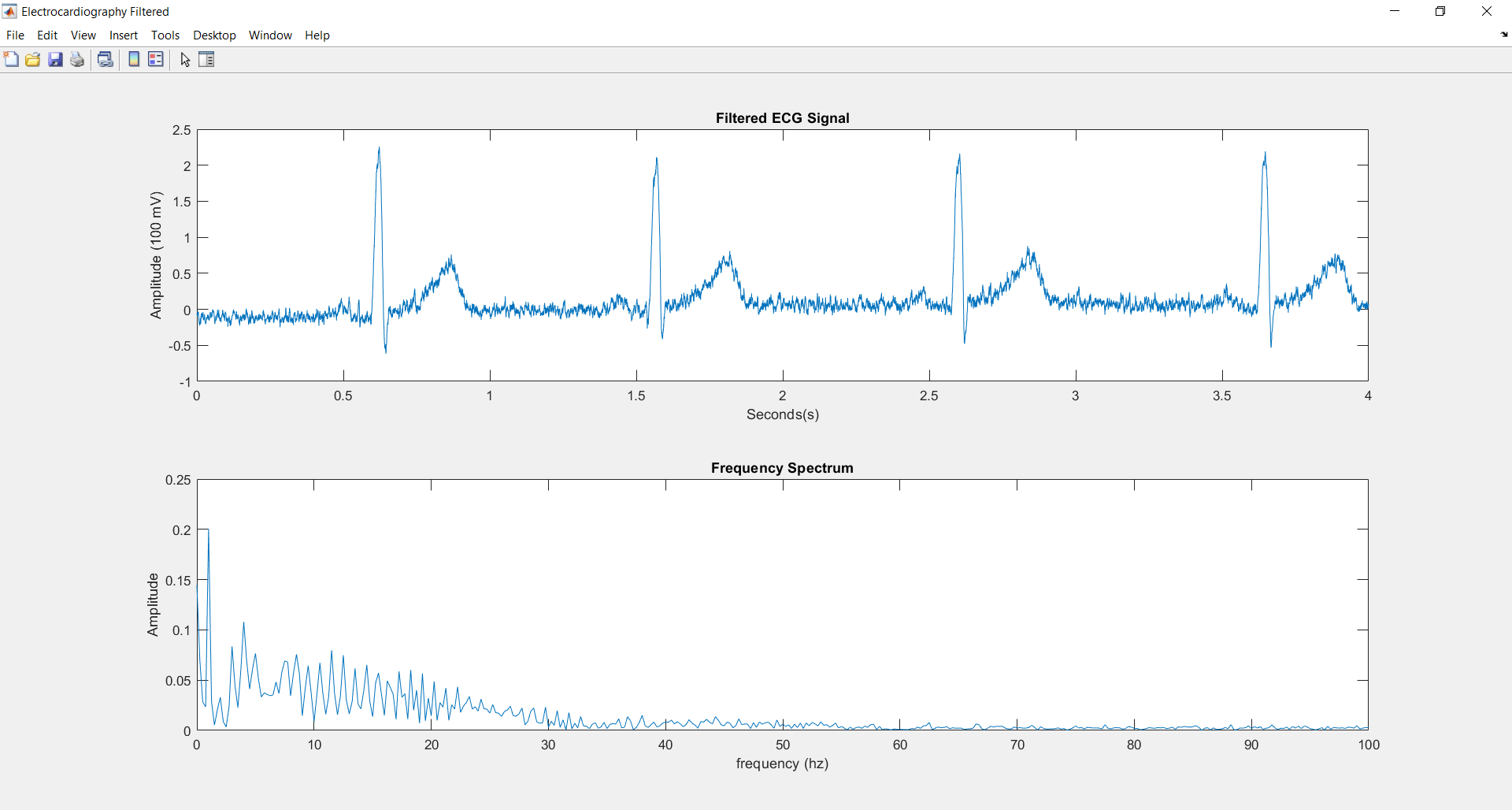  ECG Chart Filtered 