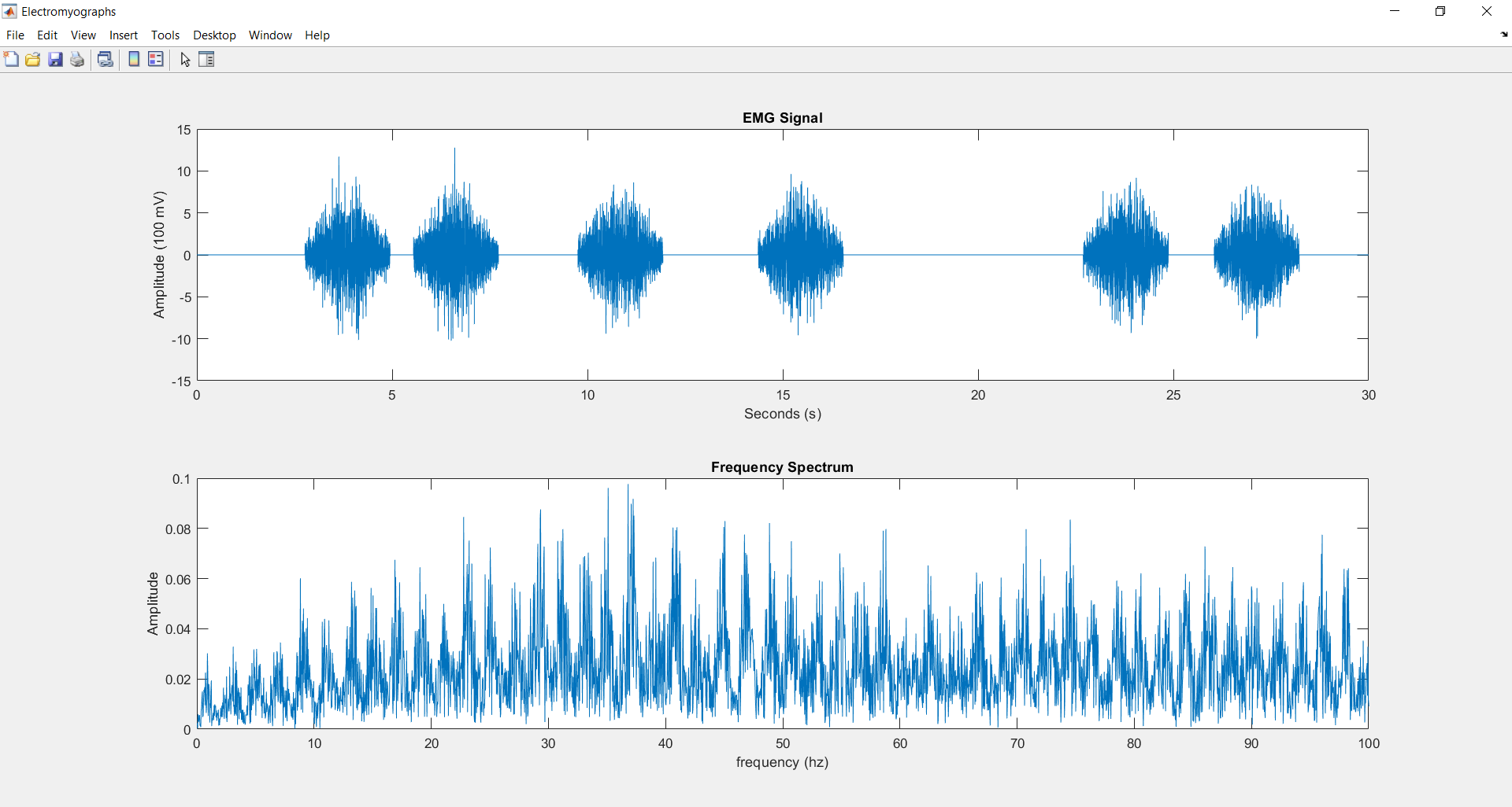  EMG Chart 