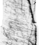kymograph