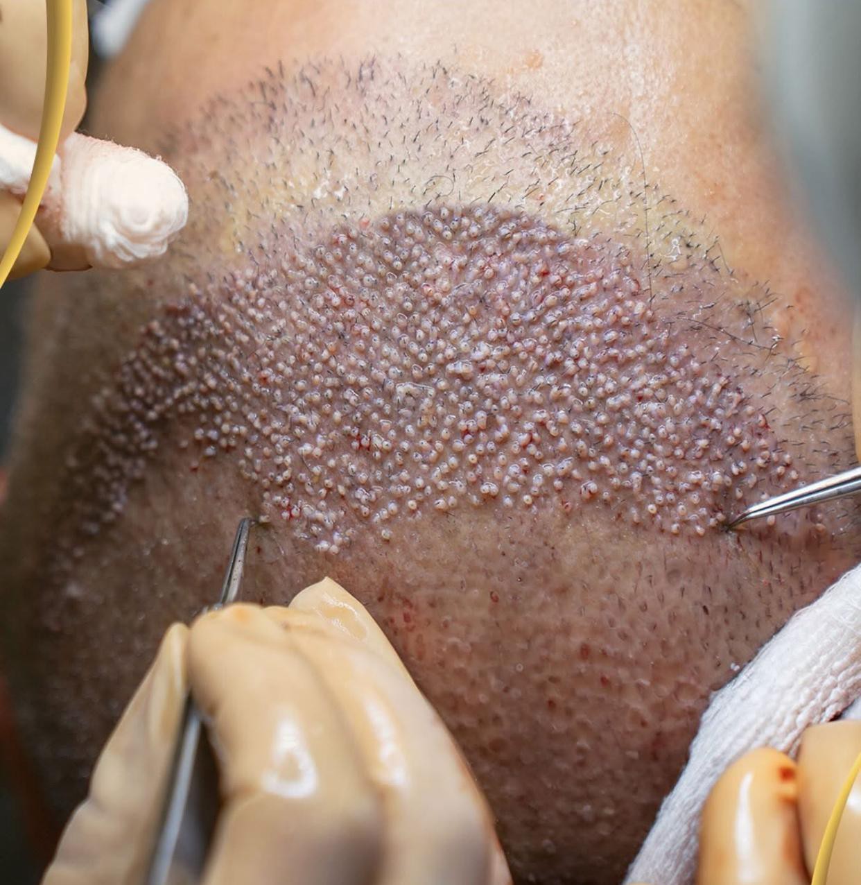 Bosgar Clinic - Client Result