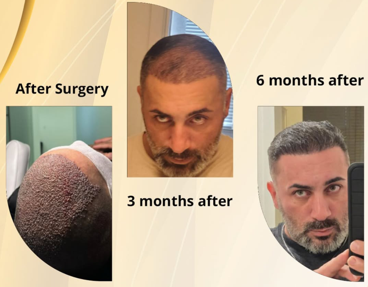 Before and After View