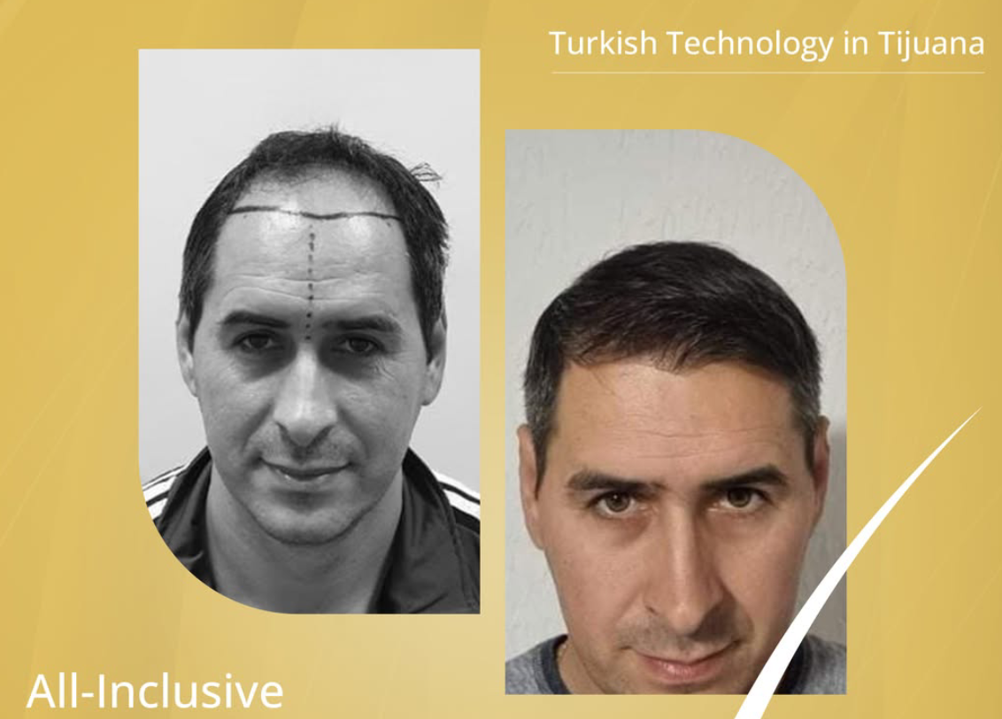 Patient Testimonials