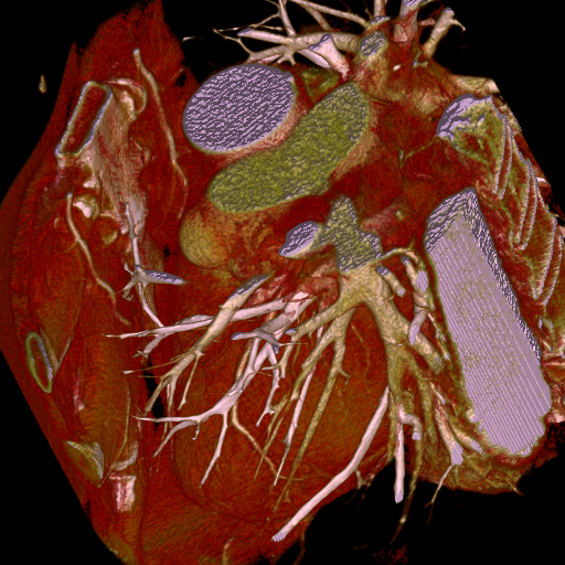 picture: Volume Render of Cardiac