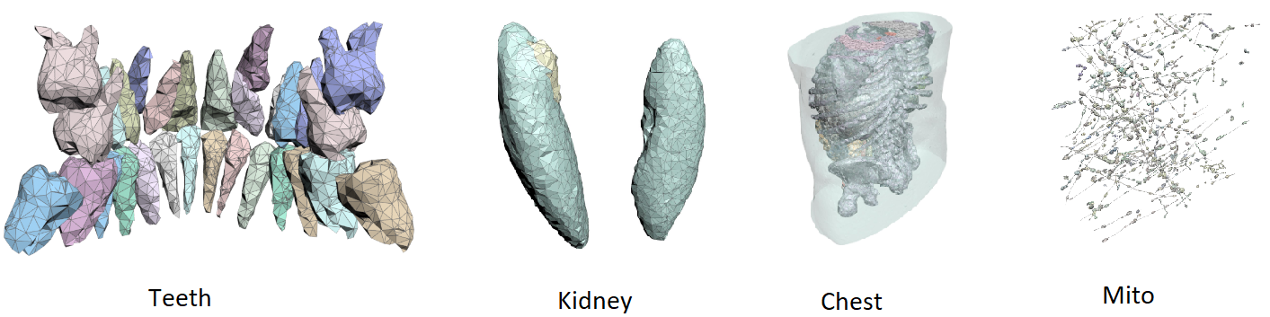 Segmentation