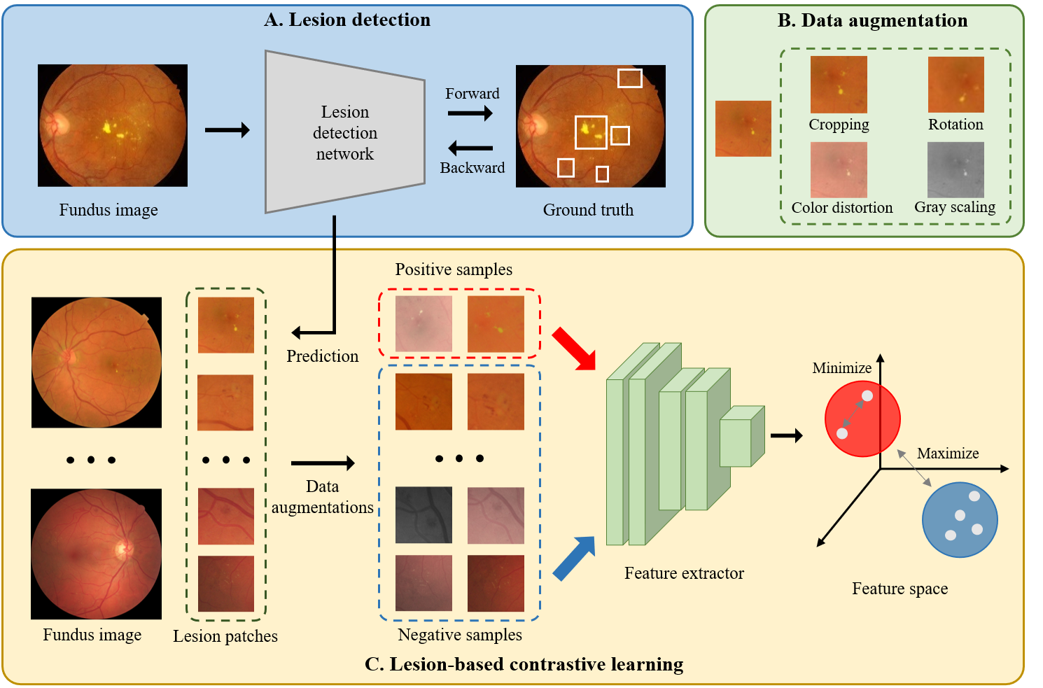 diabetic-retinopathy-grading-ai