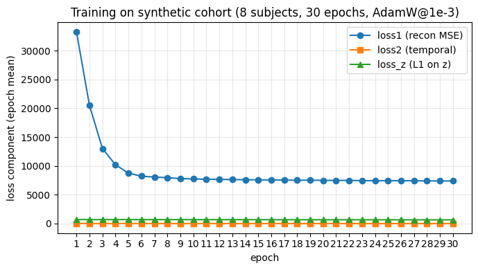 loss https://raw.githubusercontent.com/YuZh98/VAE-fMRI-Alzheimer/main/docs/assets/loss_curve.png