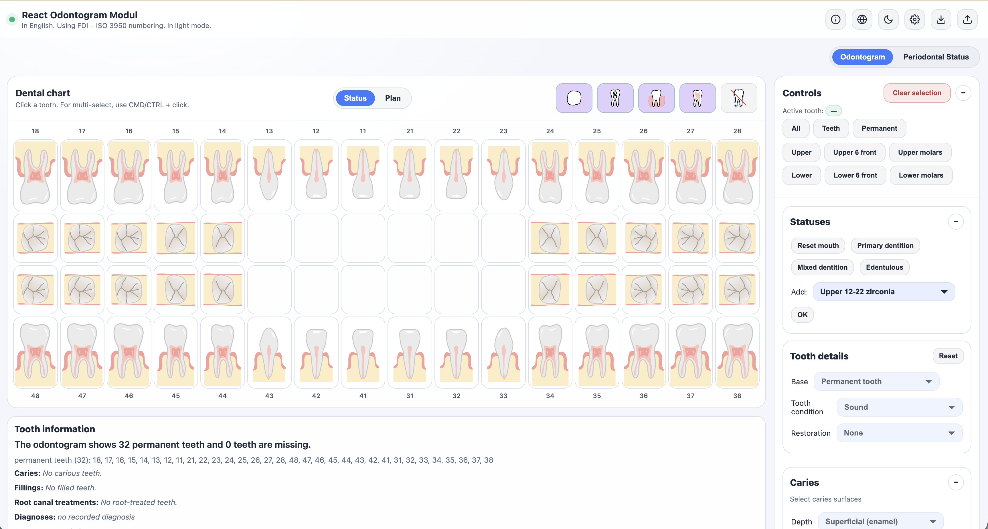 Odontogram editor preview