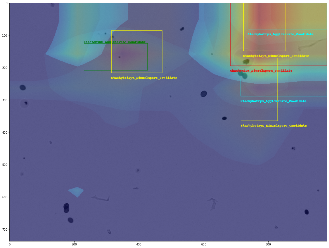 Grad-CAM++:DenseNet169