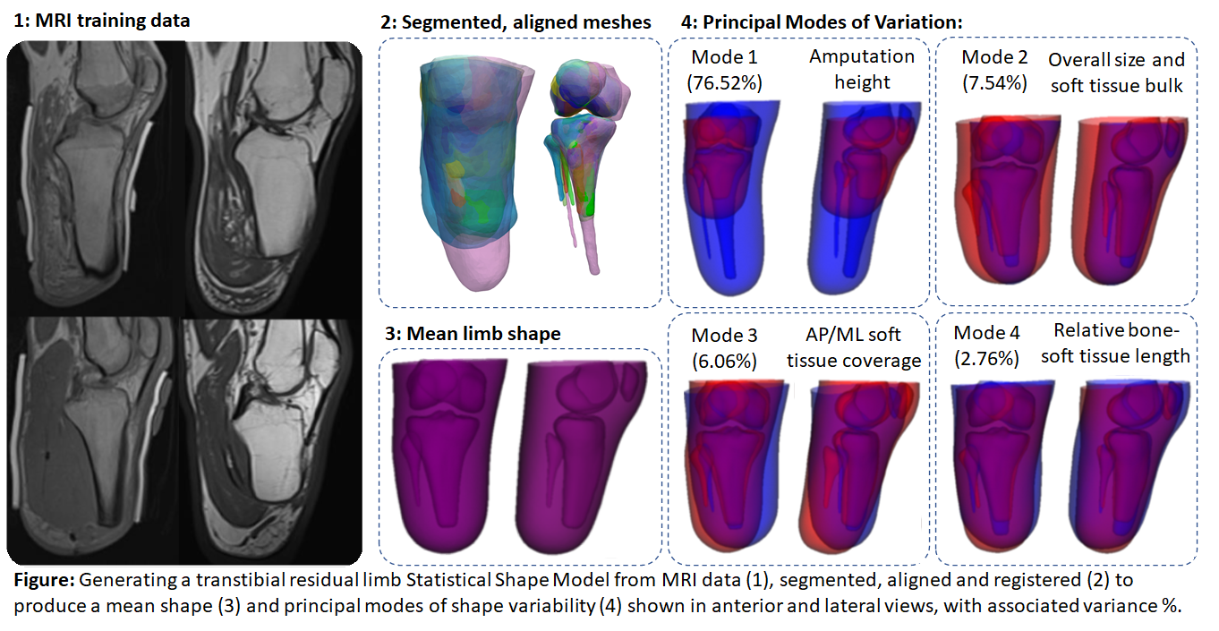 Generating a transtibial residual limb Statistical Shape Model from MRI data (1), segmented, aligned and registered (2) to produce a mean shape (3) and principal modes of shape variability (4) shown in anterior and lateral views, with associated variance %