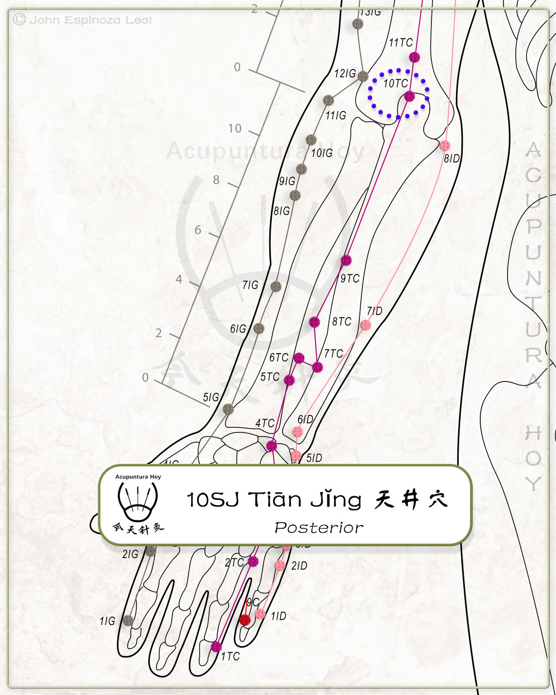 10SJ Tiān Jĭng 天井穴
