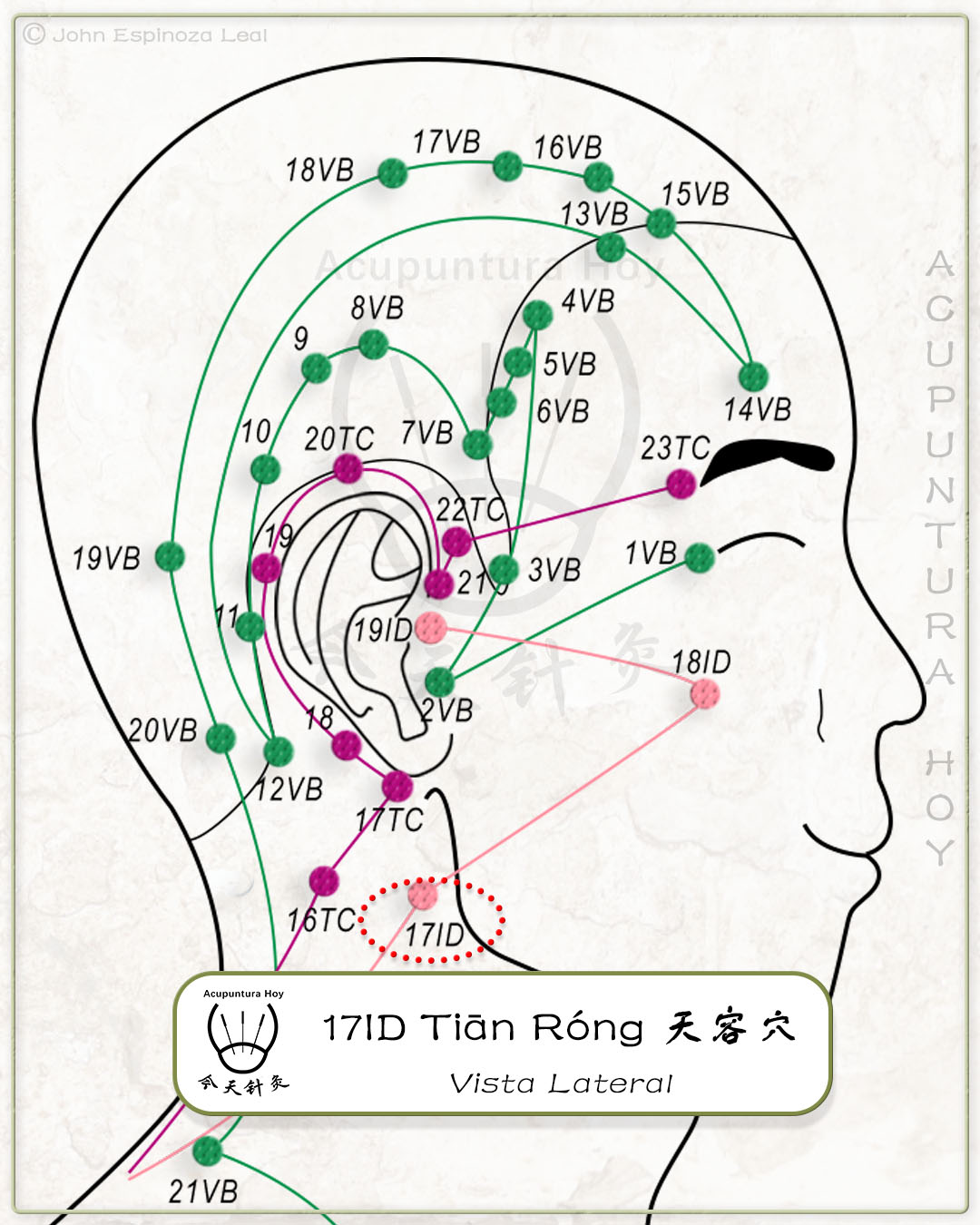 17ID Tiān Róng 天容穴