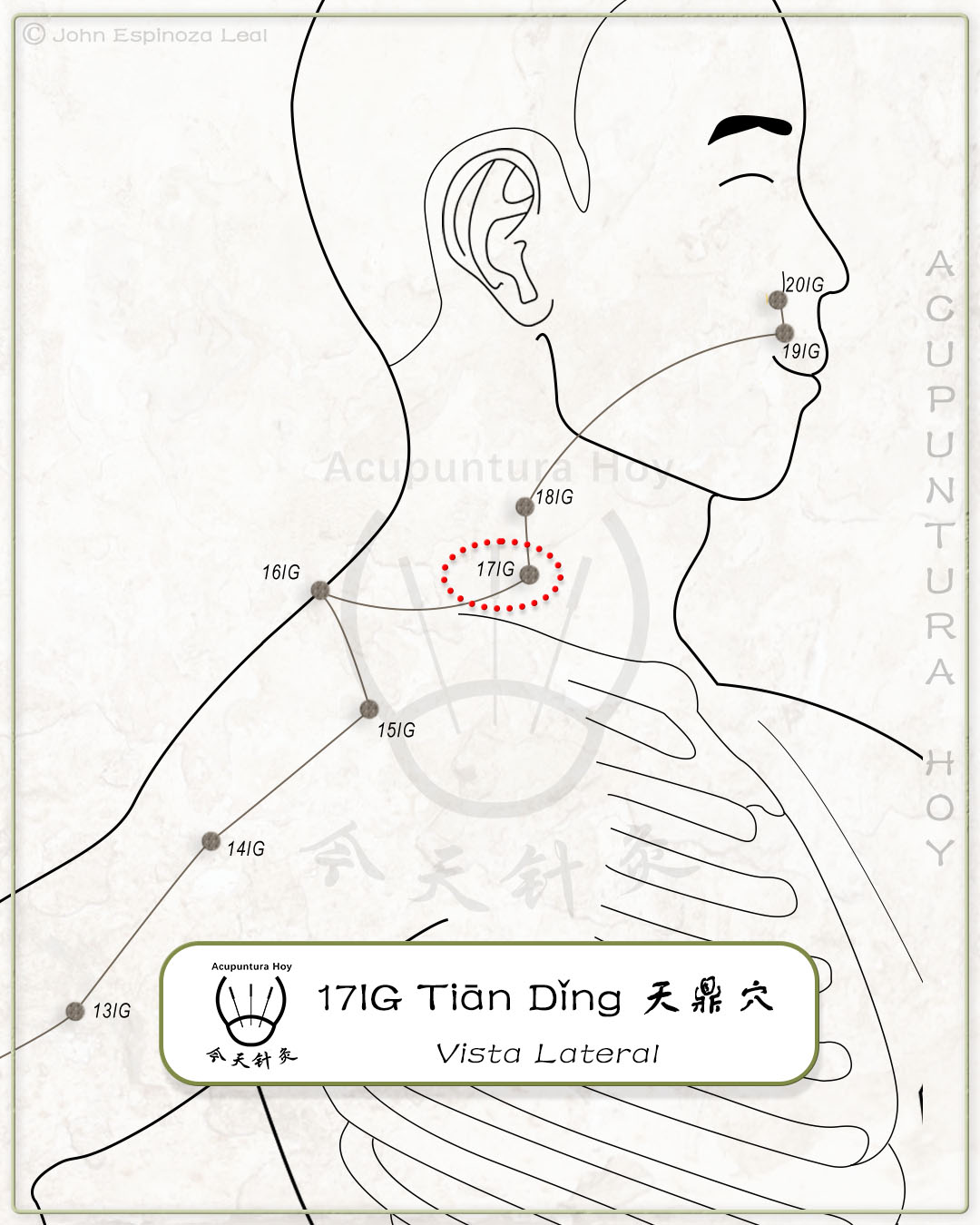 17IG Tiān Dǐng 天鼎穴