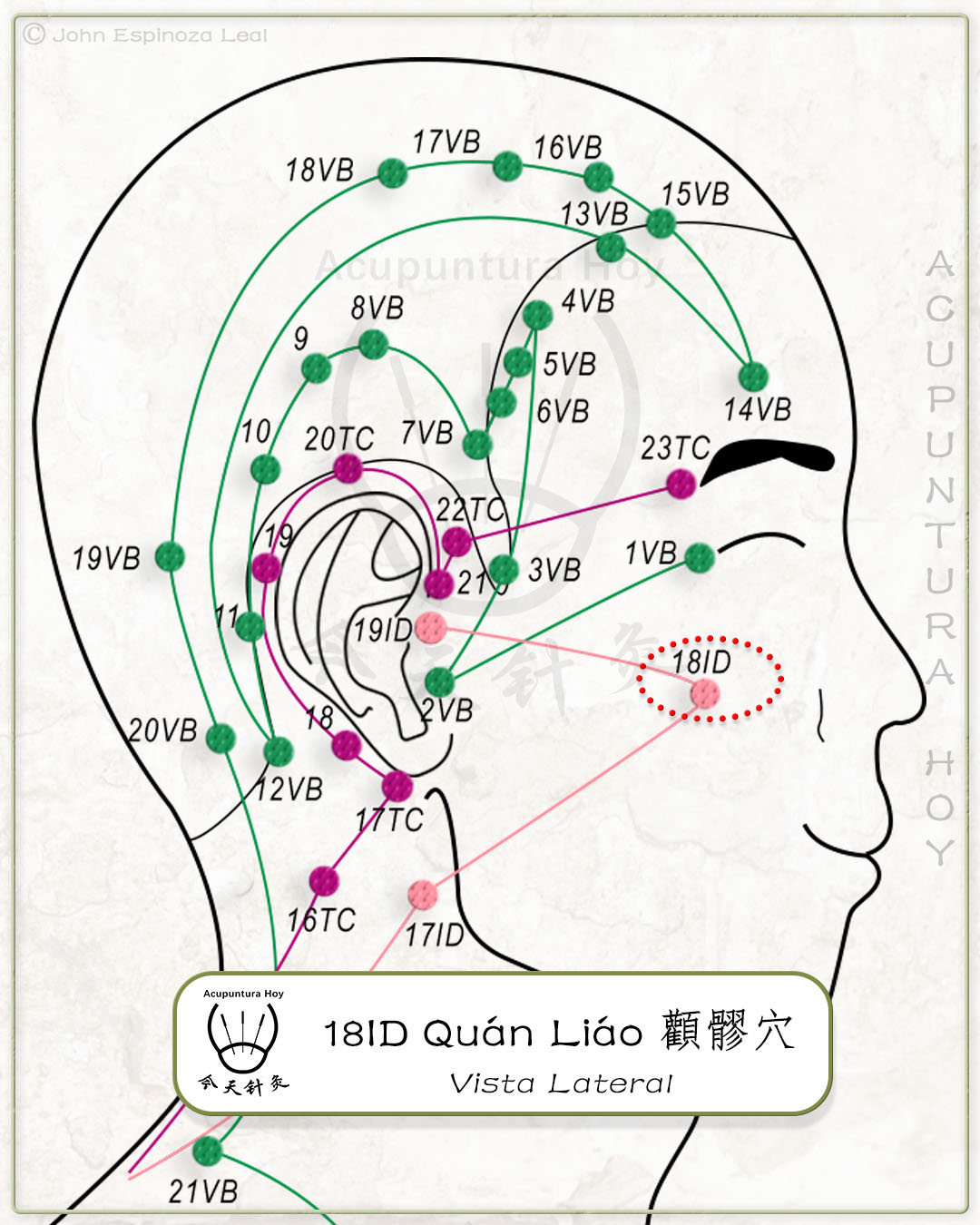 18ID Quán Liáo 顴髎穴