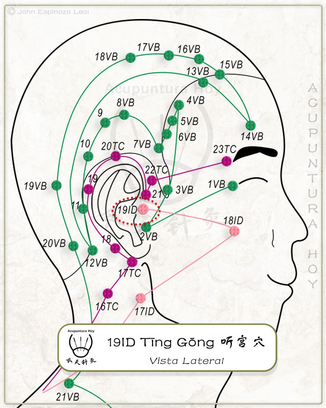 19ID Tīng Gōng 听宫穴