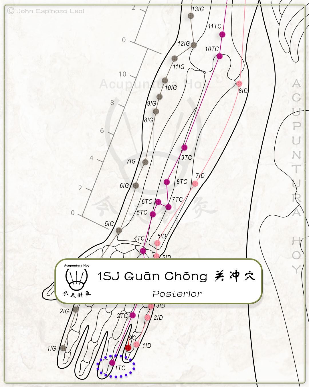 1SJ Guān Chōng 关冲穴