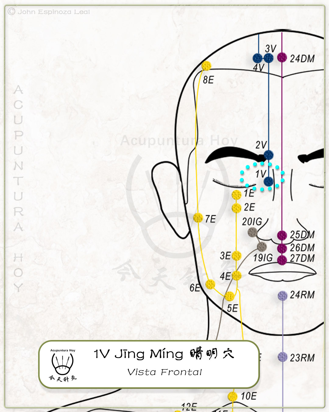 1V Jīng Míng 睛明穴